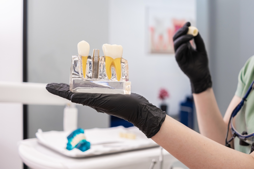 Dental Implants in Uniontown, OH & Green, OH Dental Implants in Uniontown, OH & Green, OH